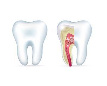 tooth extraction | root canal | new orleans